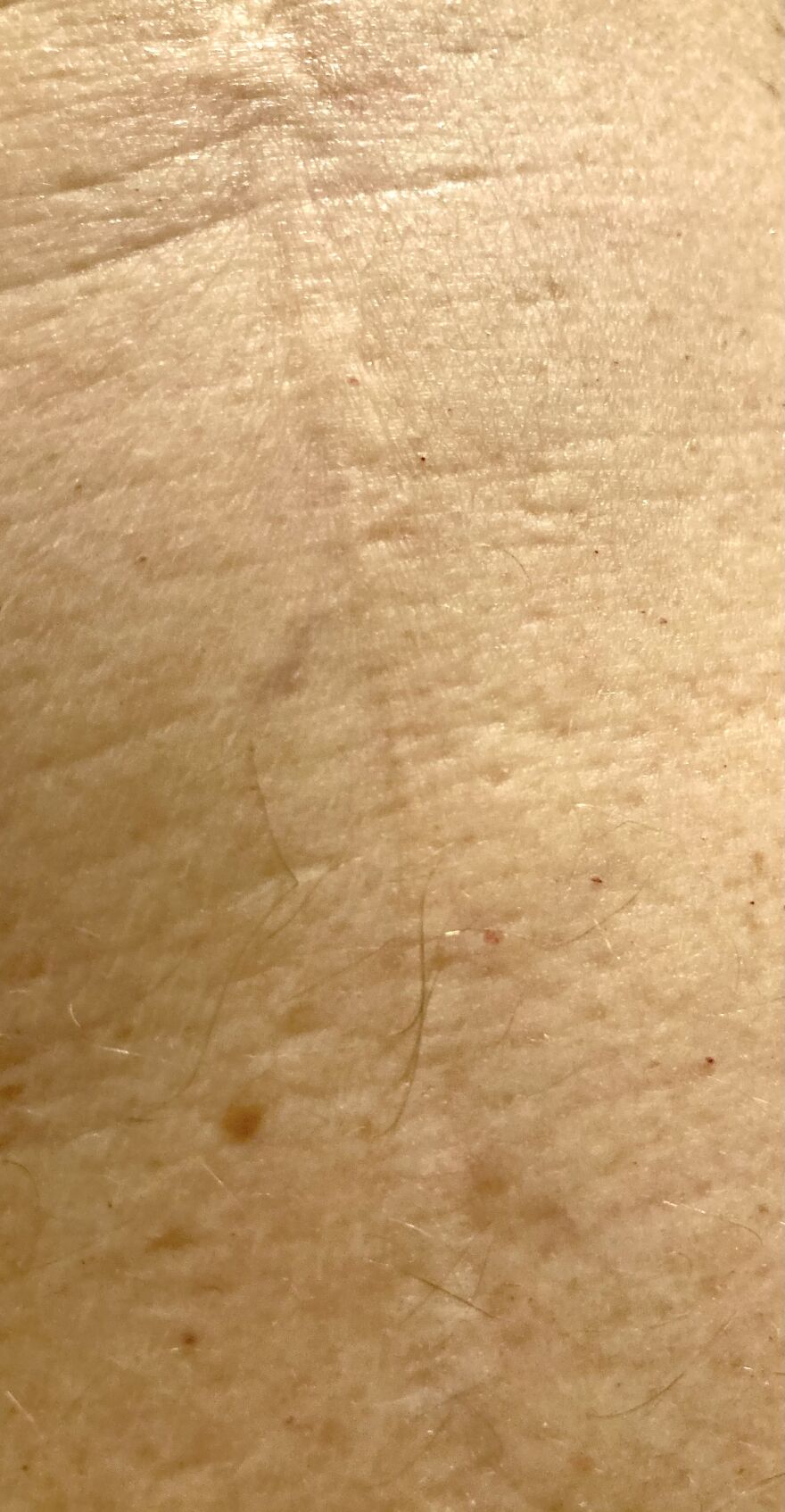 I Interview People About Their Scars I Interview People About Their Scars