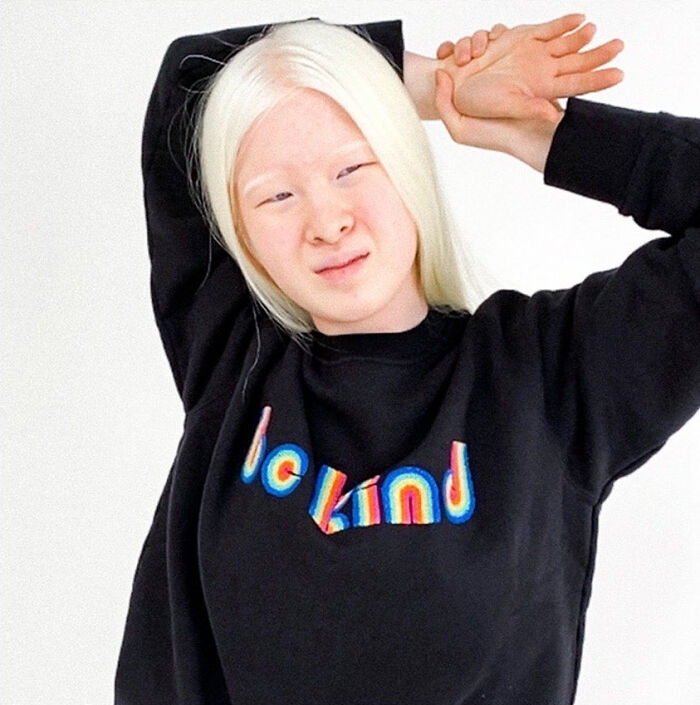 Xueli-Abbing-Chinese-Albino-Fashion-Model-Xueli-A