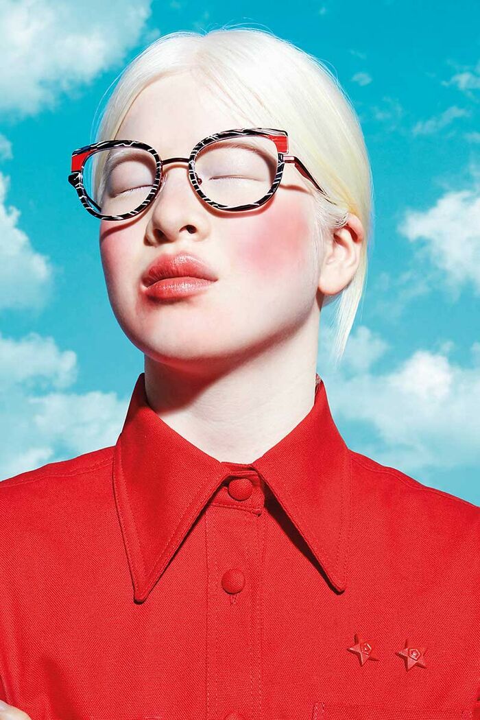 Abandoned As A Baby Due To Albinism, Xueli Grew Up To Become A Vogue Model (30 Pics)
