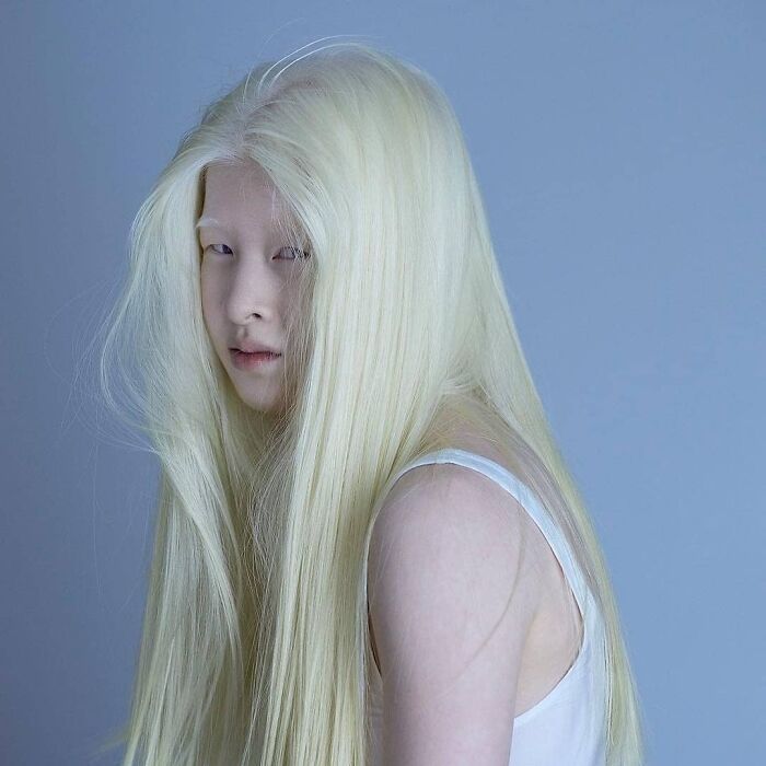 [Image: Meet-Chinese-Xueli-Abbing-the-albino-aba...3__700.jpg]