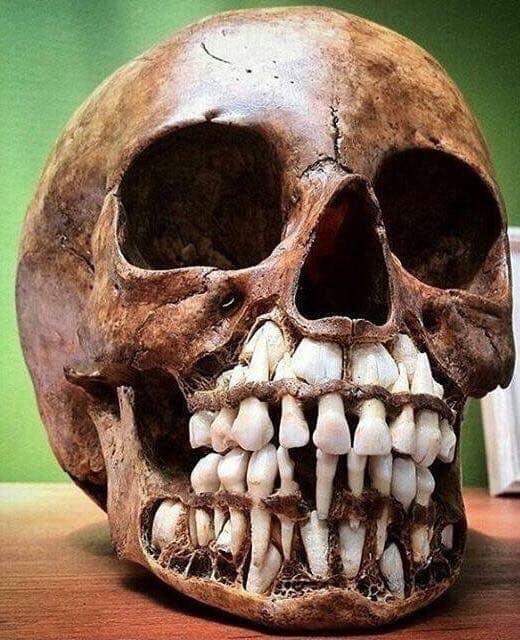 childs-skull-with-teeth-60a86951667ac.jpg