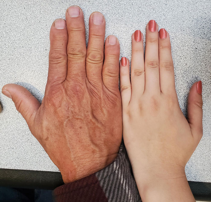 I Inherited This Small Gap Between My Middle And Ring Finger From My Dad. Both Hands Are Like This