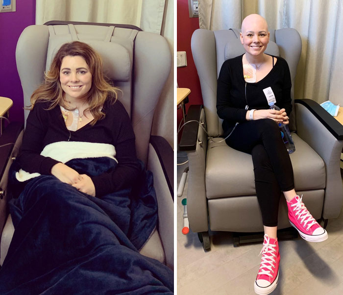 El primer día de quimioterapia vs. el último