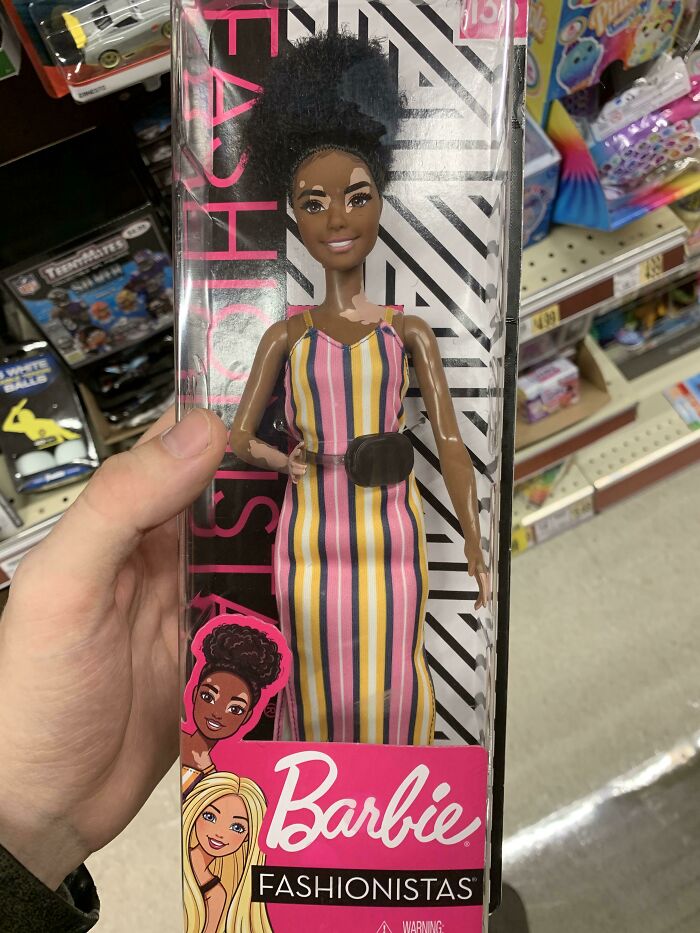 Esta muñeca Barbie con vitiligo