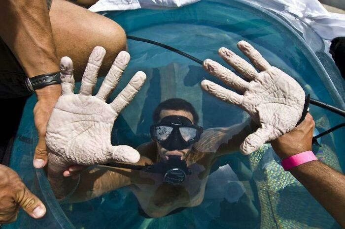 David Blaine’s Hands After Spending 7 Days Underwater