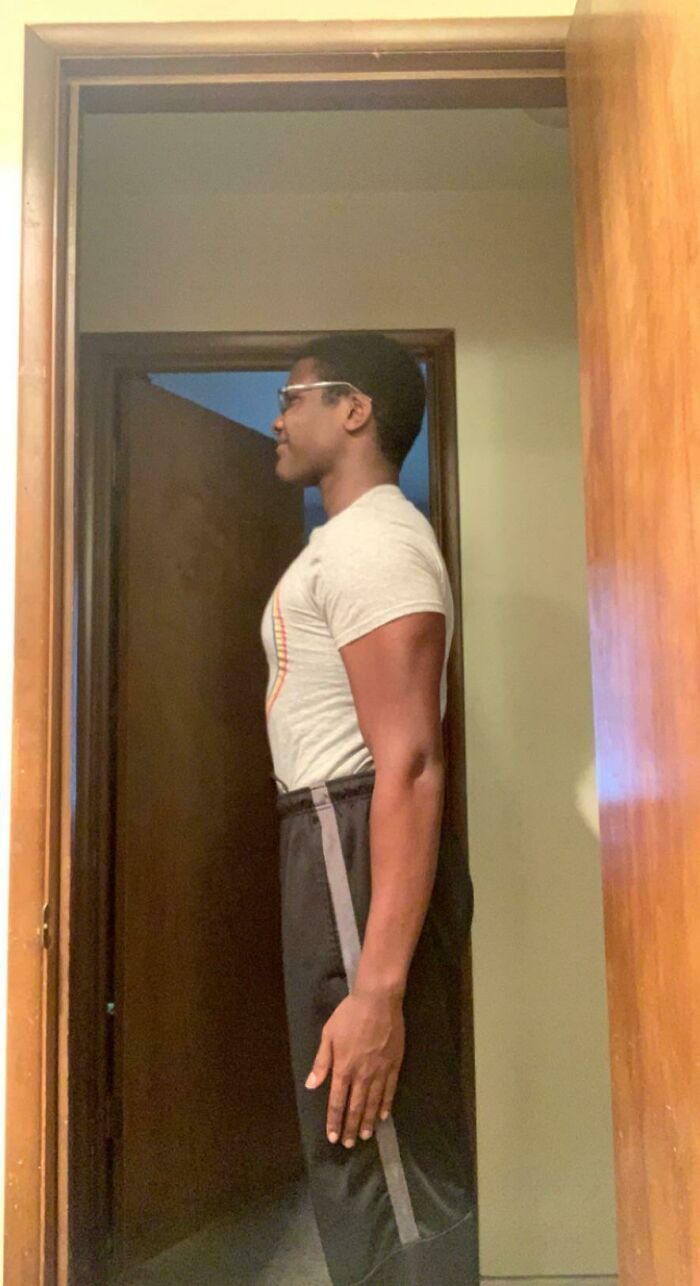 I (17m) Have Abnormally Long Arms 5’9 With A 6’6 Wingspan