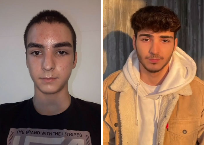 Tiktok-Glowup-Puberty-Before-After