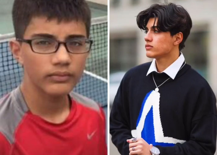 Tiktok-Glowup-Puberty-Before-After