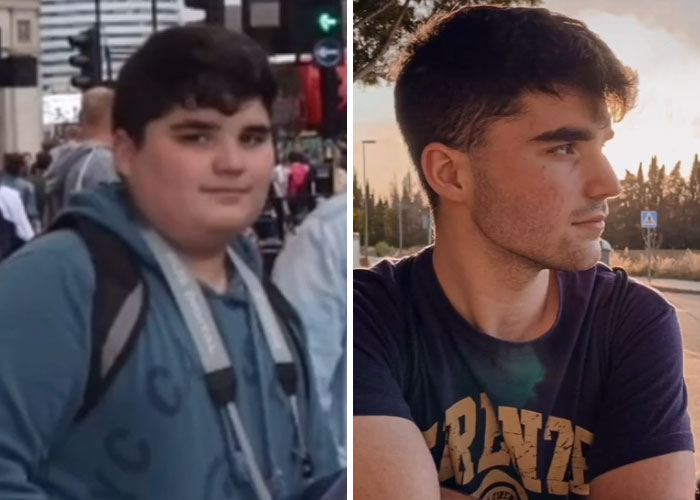 "How Hard Did Puberty Hit You": 30 People Who Took Part In This New TikTok Challenge And Shared Photos