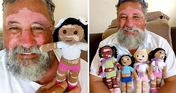 Un abuelo con vitíligo teje muñecas de crochet con la misma condición para hacer que los niños se sientan mejor