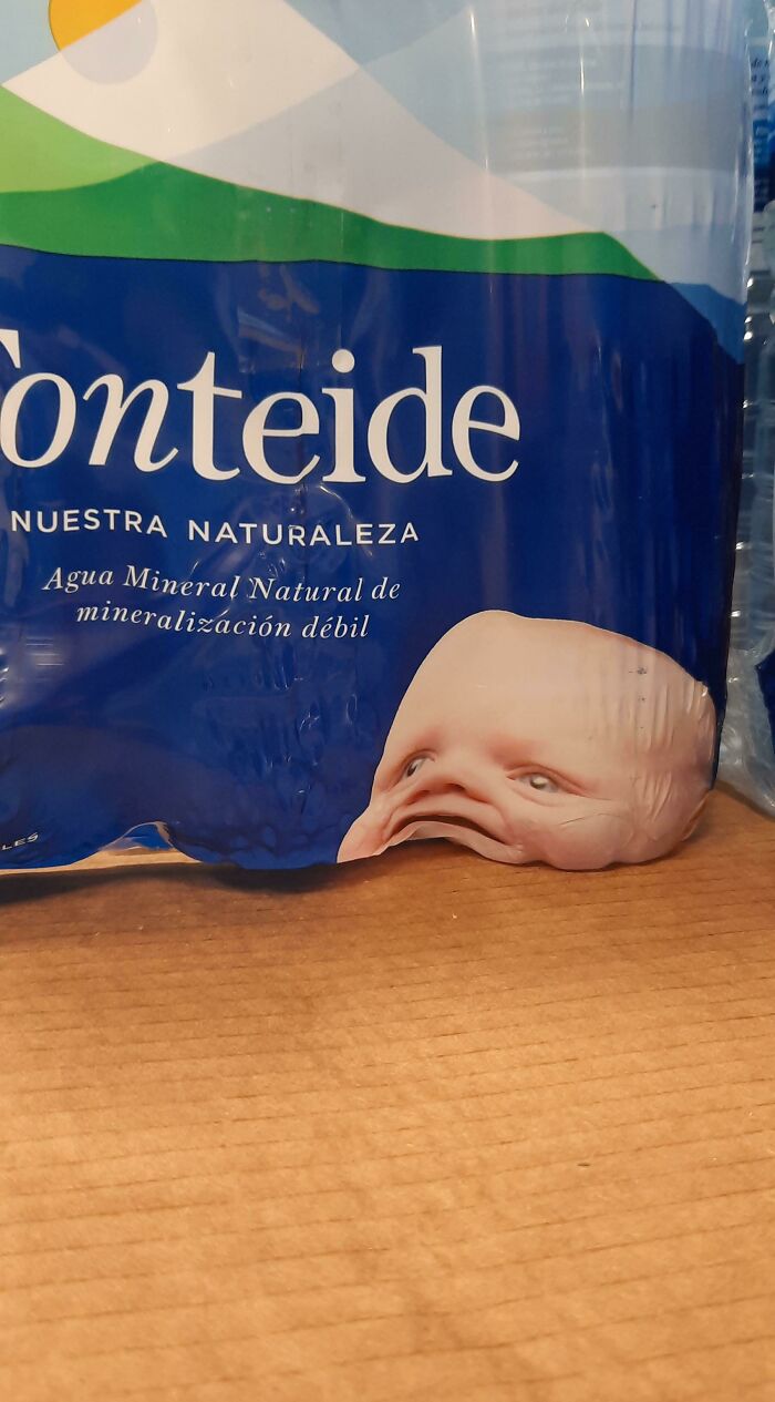 The Placement Of This Baby's Head Wasn't Quite Thought Through