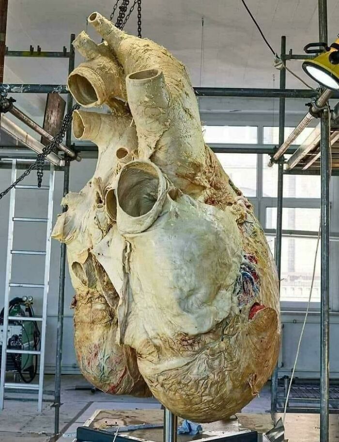 This Heart Of A Blue Whale