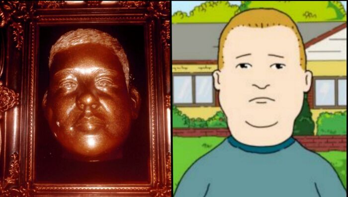 My Brother(10yrs Old) Had A Cast Made Of His Face In School And When He Showed It To Me I Immediately Thought To Myself "He Looks Like Bobby Hill", I Mean Im Not Wrong Right? He Looks Just Like Him Hahaha