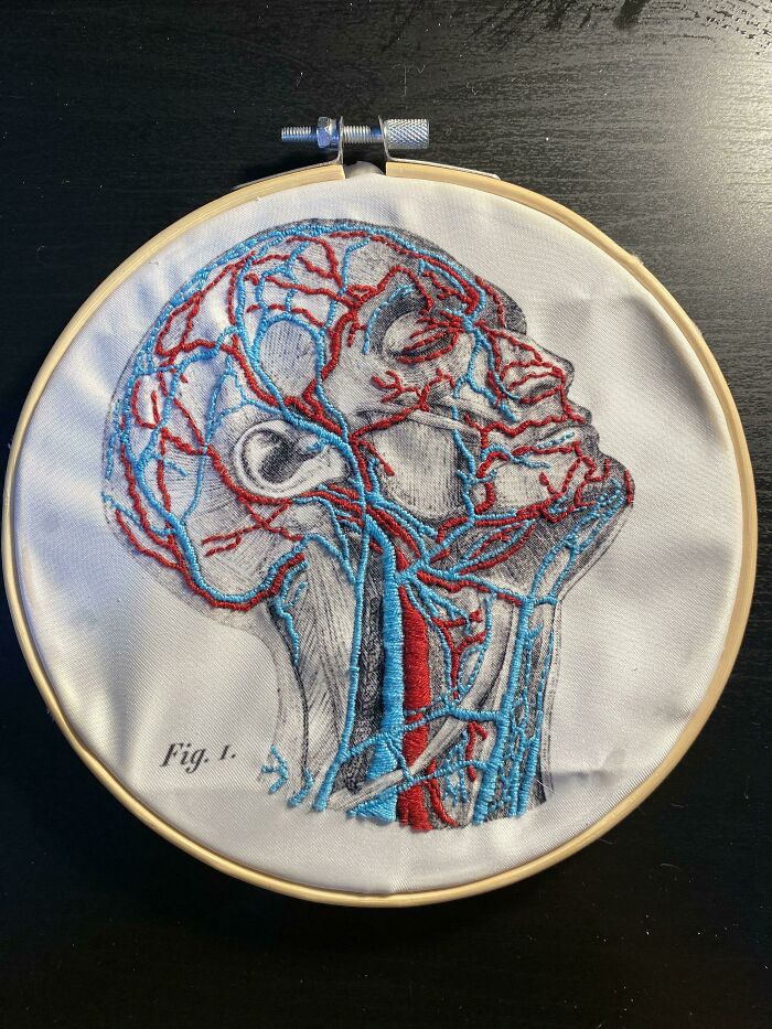 Spent My First Day Of School Quarantine Embroidering The External Carotid Vessels