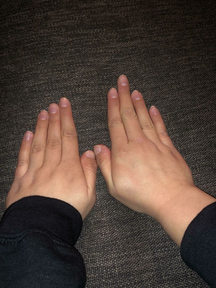 My Girlfriend Has Different Finger Structures