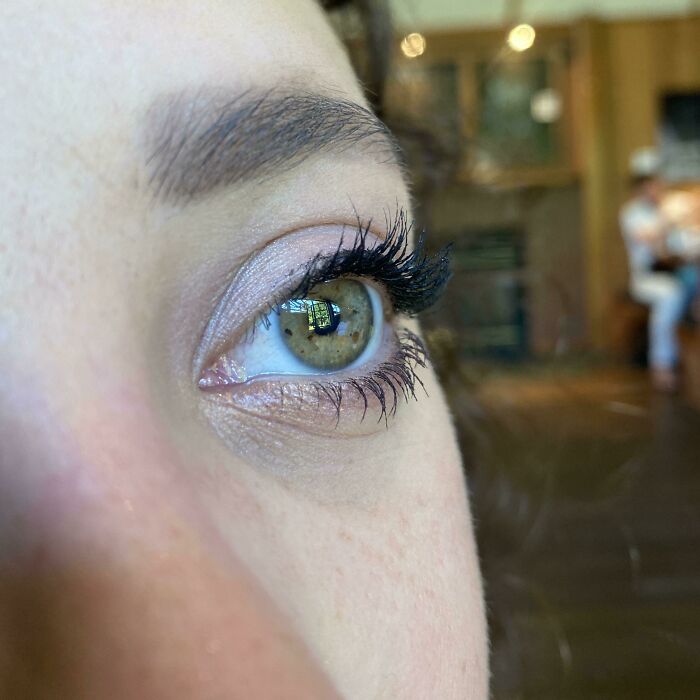 My Girlfriend Has Freckles In Her Iris. They Look Like Marbles