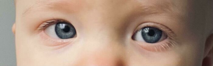 My Daughter Has Different Color Eyelashes
