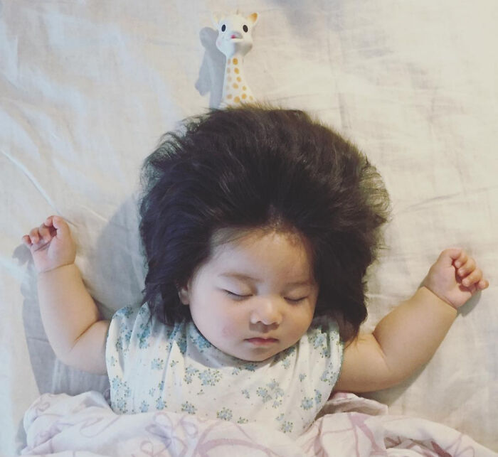Baby Chanco Was Born With A Lot Of Hair Which Kept Growing. This Is Her At 7 Months Age