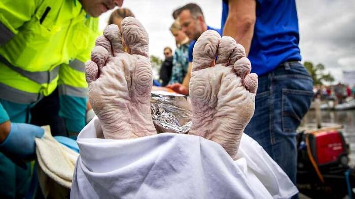 Pies del campeón olímpico de natación holandés Maarten Van Der Weijden tras nadar 163 km/101 millas en 55 horas para recaudar fondos para la investigación del cáncer