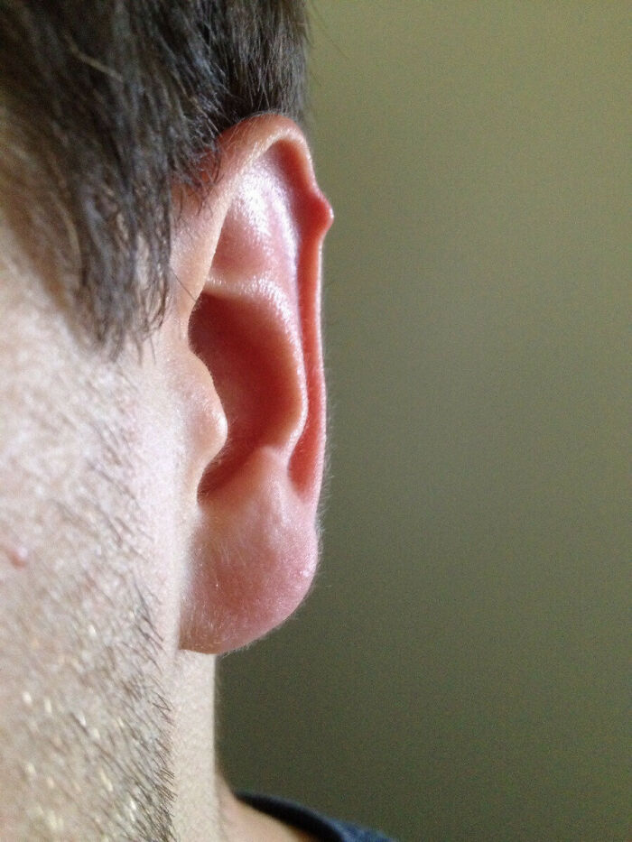 My Ear Has A Sharp Bump. It's Fun To Touch