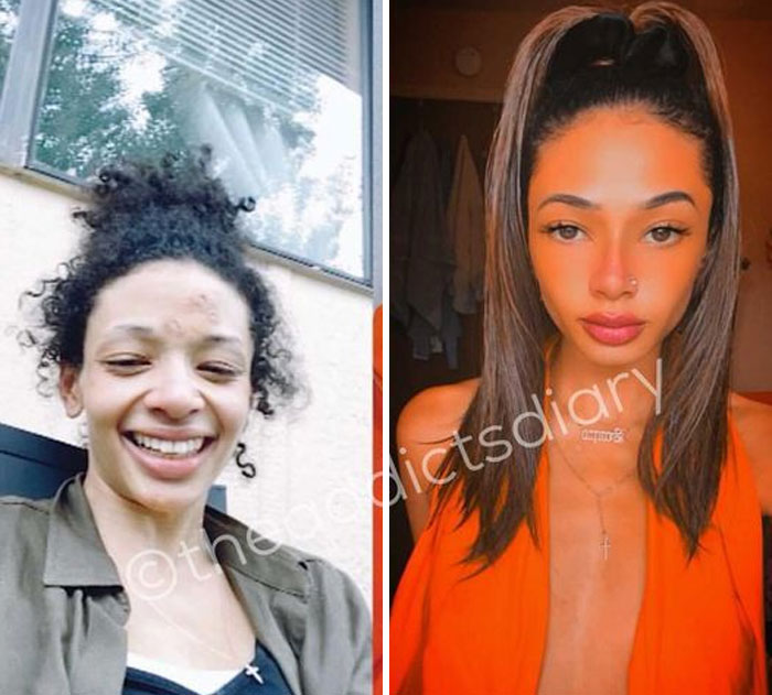 Drug-Addiction-Before-After-Transformation-Photos