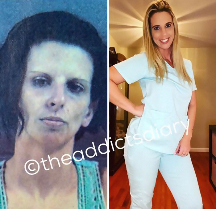 ‘The Addict’s Diary’: 30 Powerful Before & After Transformations Of Drug Addicts (New Stories)