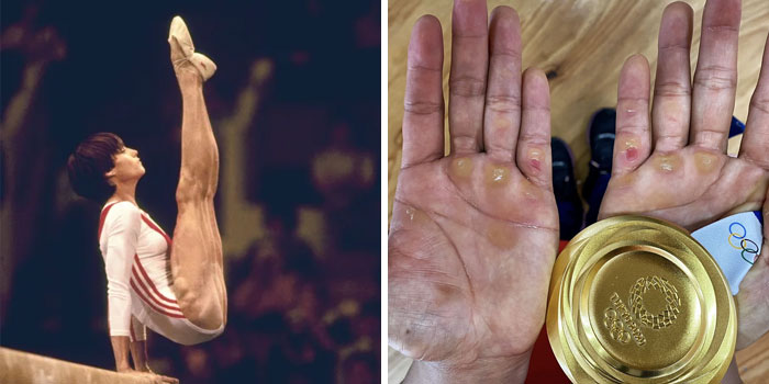 50 Freaky Photos Of Olympians And Other Athletes To Give You A New Perspective On The Human Body