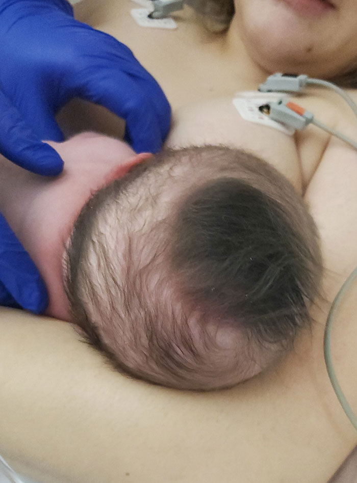 A Super Thick Tuft Of Hair On My Newborn Daughter's Head