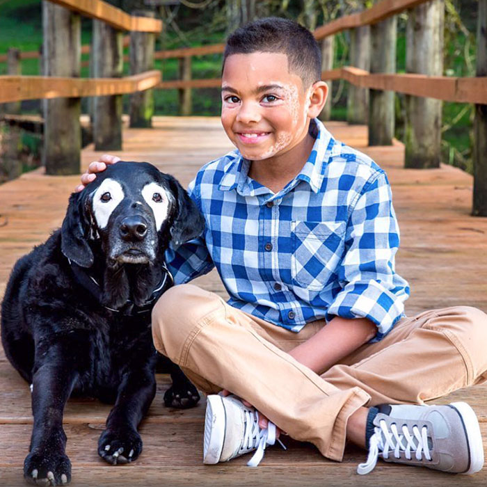 8-Year-Old Carter Blanchard And Rowdy The Dog Both Have A Disorder Called Vitiligo