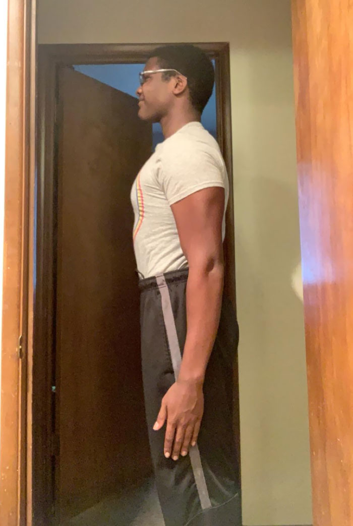 I (17M) Have Abnormally Long Arms 5’9 With A 6’6 Wingspan