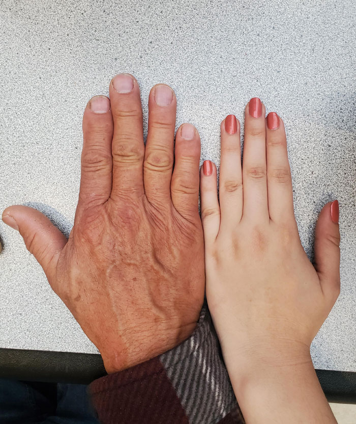 I Inherited This Small Gap Between My Middle And Ring Finger From My Dad. Both Hands Are Like This
