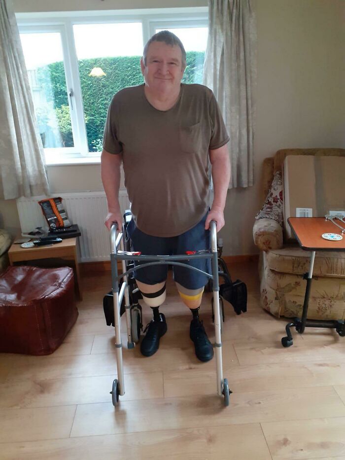 This Is My Dad. Since I Saw Him Last He Lost Both Of His Legs. This Is The First Time My Dad Has Stood Up Without Having Someone To Help Him, And I’m So Proud Of Him