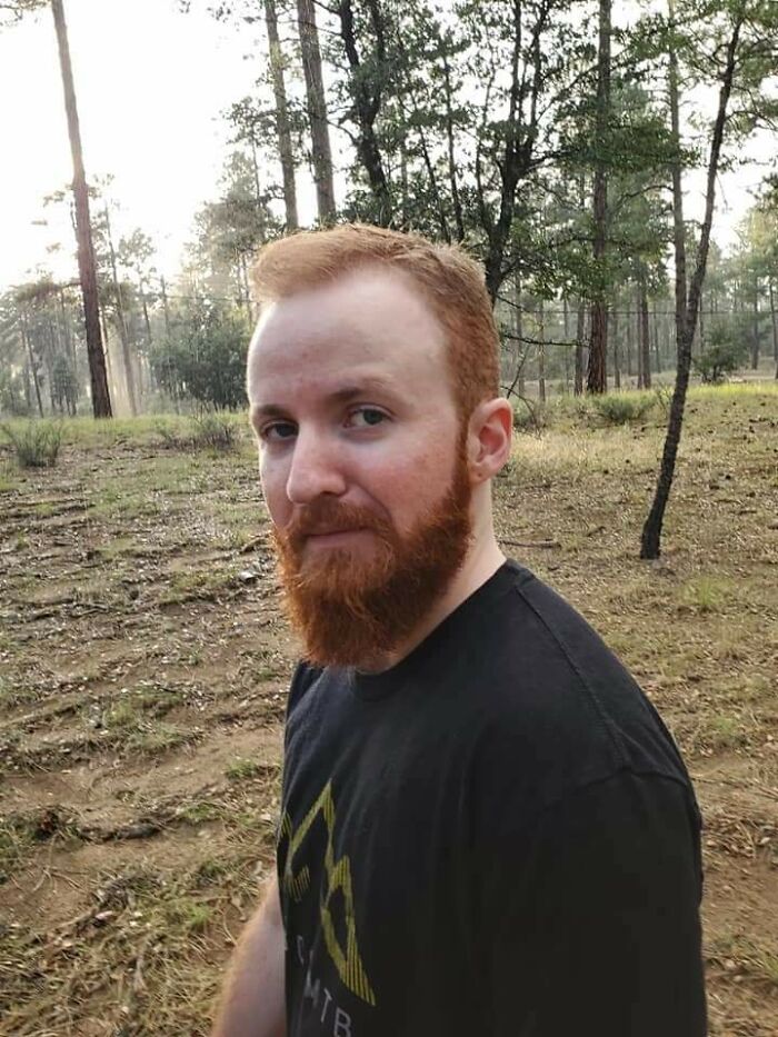 After 7 Years Transitioning, My Husband Still Struggles With His Image. He Thinks He Doesn't Pass As A Man. But Look At That Beard. I Couldn't Be More Proud Of Him