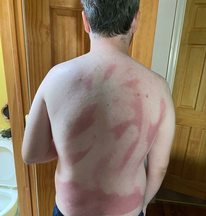 To Put Sunscreen On My Back