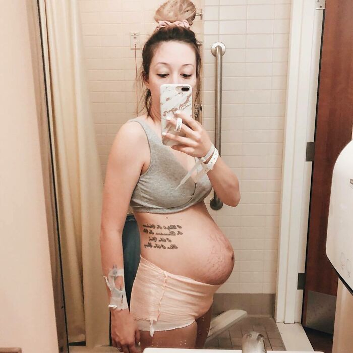 30 Honest Photos Of Post-Baby Bodies That Women Are Sharing To Reveal The Truth That Few People Talk About (New Pics)