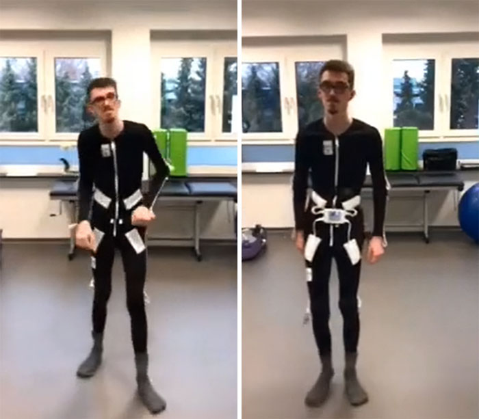 A Swedish Engineer Has Invented A Suit That Will Change The Lives Of People With Parkinson's And Stroke. With The Help Of Electrical Stimulation, It Helps To Get Rid Of Tremors