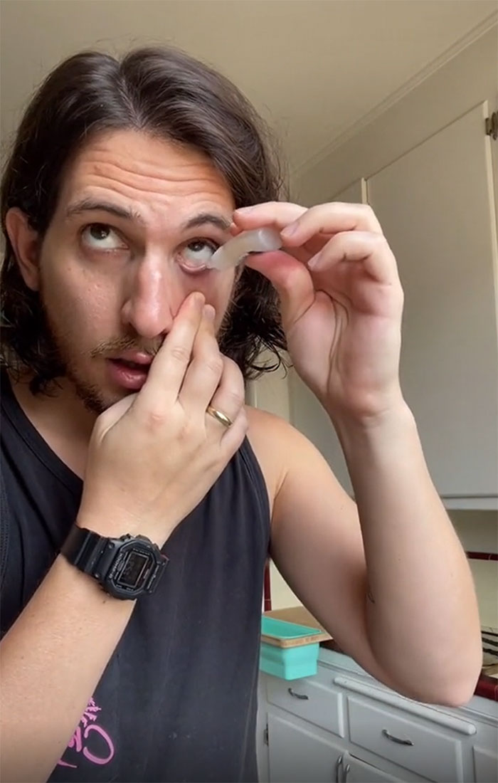 How To Put Eyedrops In Your Eyes. Eyedrops, Bottom Of The Eyelid, Pull Down, Make A Cup And Then Boom. Not Scary, Doesn't Miss, Perfect Application. That's So Refreshing, I Gotta Do I Again