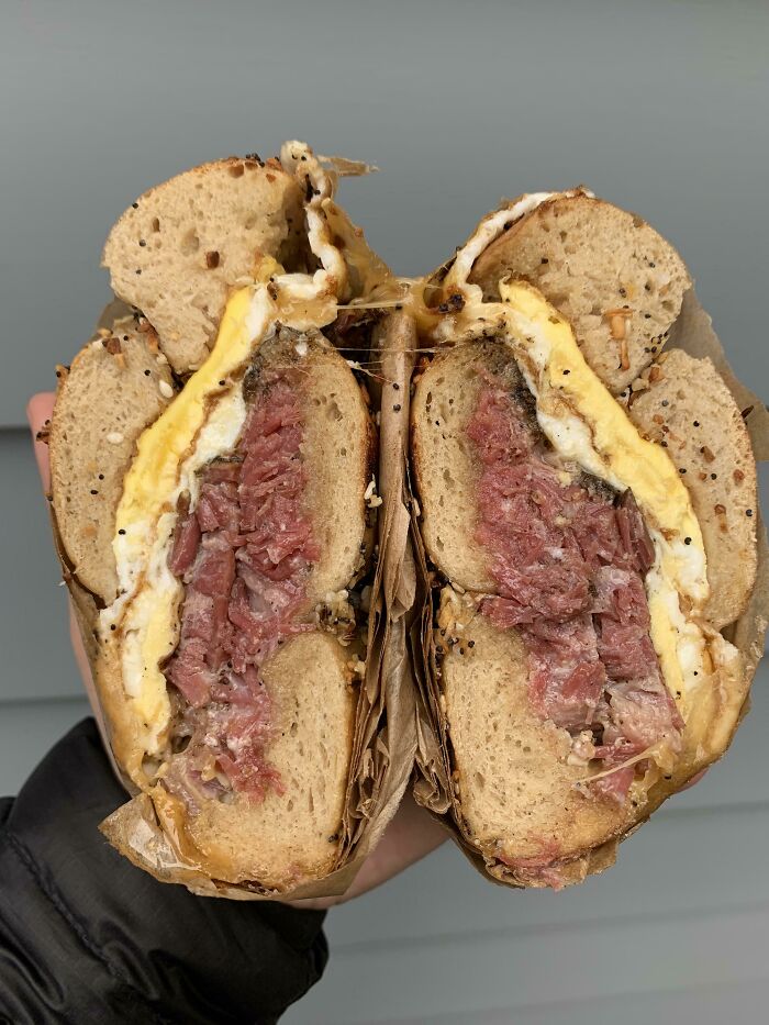 A Pair Of Lungs Taken From A Chronic Smoker That Died Due To Covid Related Complications