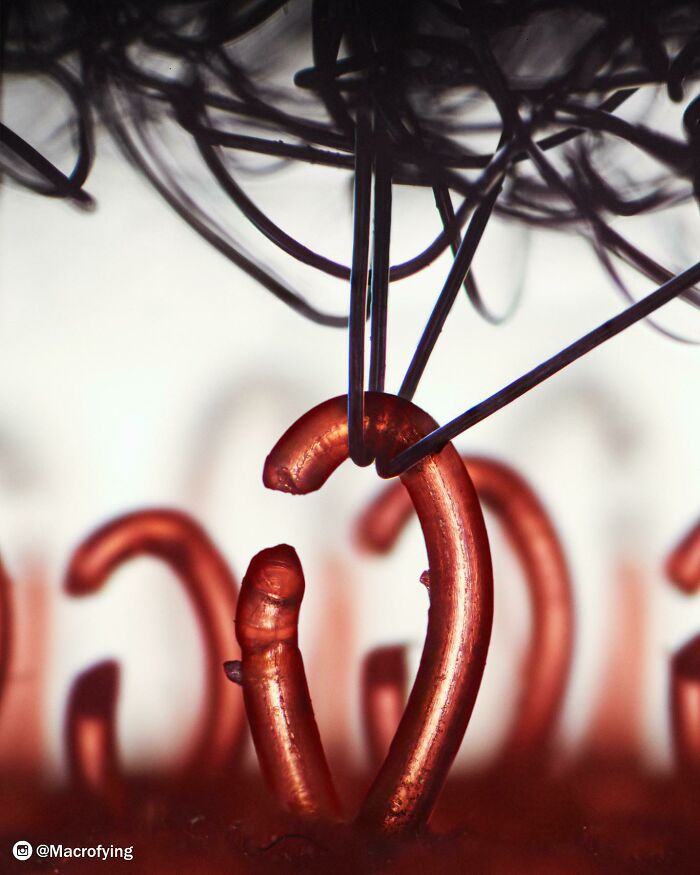 Microscopic Parasite Removal