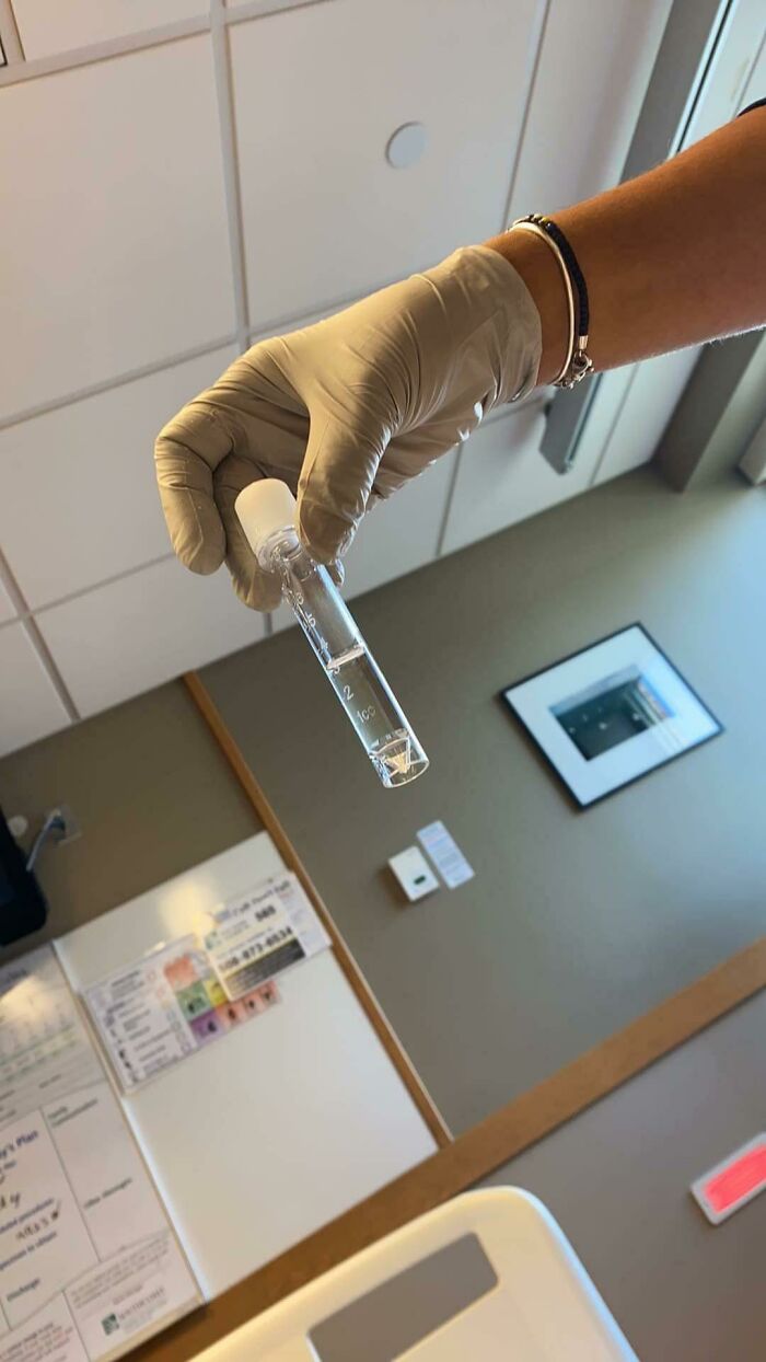 The Wonderful Nurse Who Did My Lumbar Puncture (Spinal Tap) In The Hospital Let Me Take A Picture Of My Cerebral Spinal Fluid!