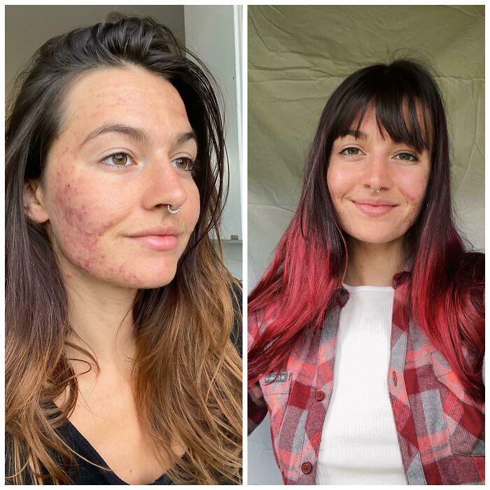 I, Among Many, Have Fallen Victim To The Quarantine Bangs