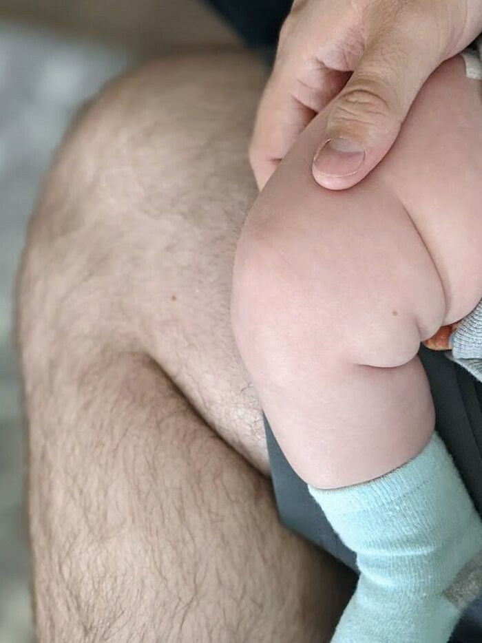 My Son And I Have Matching Freckles In The Same Spot