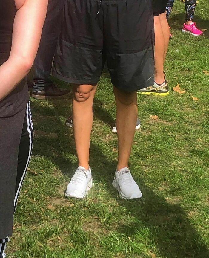 Legs with mismatched knees and white sneakers on grass, showcasing a weird moment from the I Want To Leave Instagram account.