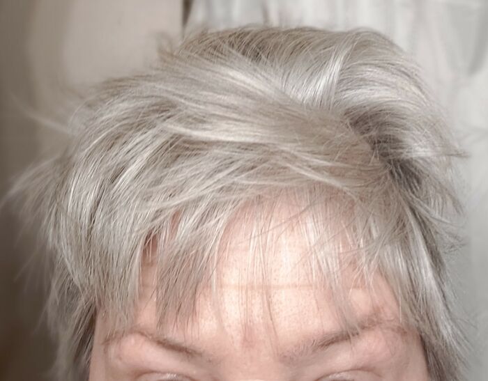 This Actually Hurt. Not Just To Look At