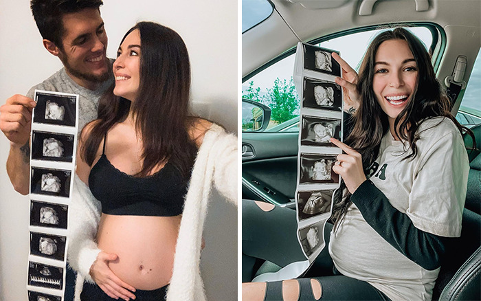 Pregnant Woman And Cat Give Birth At The Same Time After She Found The Pregnant Cat And Fostered Her