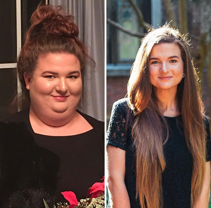 Photo On The Left Was From 2 Years Ago Today And I’m Still Shocked That I Actually Have A Neck