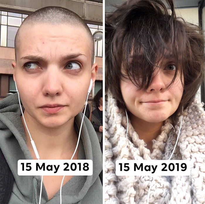 One Year Ago I Buzzed My Head, And Now The Floof Is Back (And I Gained White Hair)