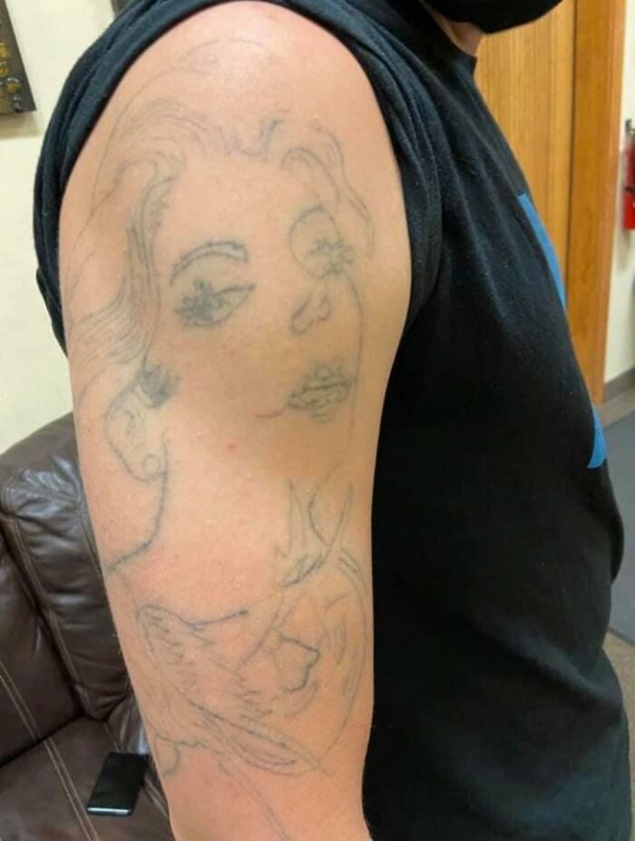 Person with a poorly done tattoo drawing on arm, showcasing bad ink work.