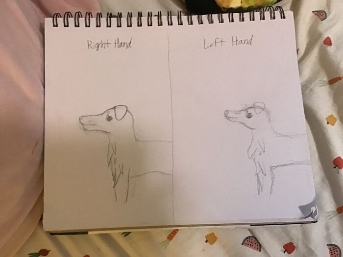 The Difference Between My Right Hand And Left Hand. This Is My Dog Jack.