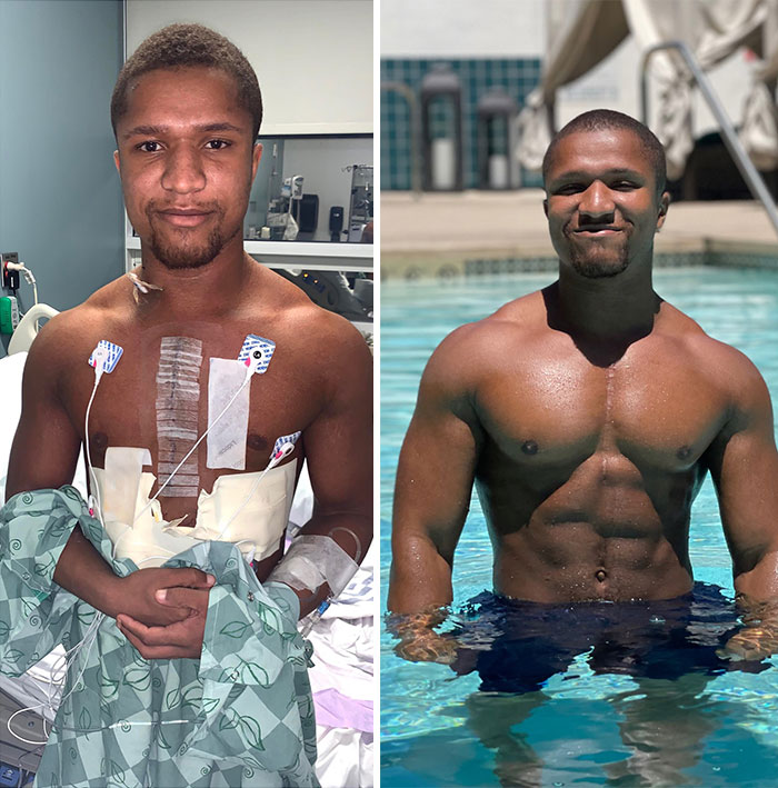 Vi la foto de la izquierda en mis fotos de Google y me sentí orgulloso de mí mismo. Un año y medio después de la cirugía a corazón abierto